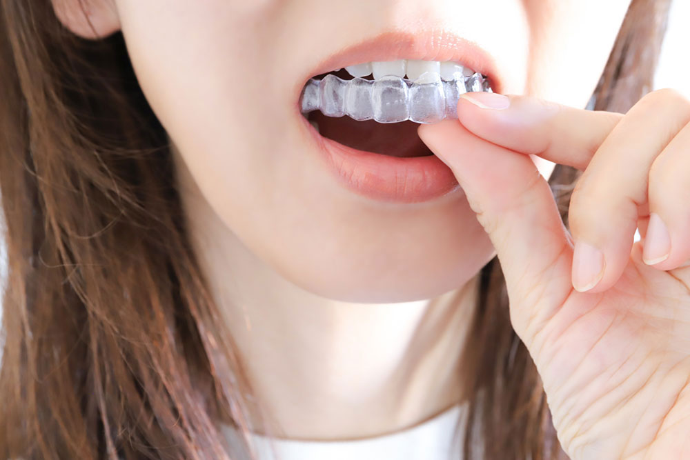 見た目だけでなく健康にもつながる矯正治療